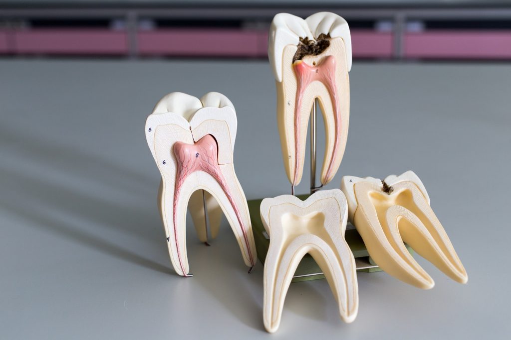 Tooth model